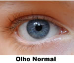 olho_normal.jpg